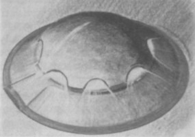 Arthur Strauch's sketch of the object as seen through binoculars